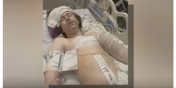 유타주 경찰, 13살 자폐소년에게 발포