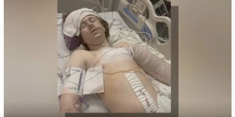 유타주 경찰, 13살 자폐소년에게 발포