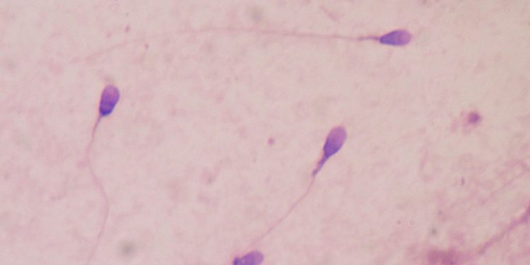 코로나19 감염, 남성 정자 절반으로 줄어든다