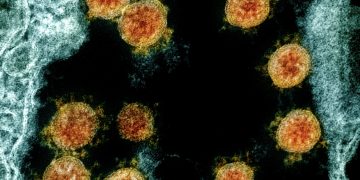 달라스, 코로나 변이바이러스 감염 의심환자 발생 … “해외여행기록 없어”