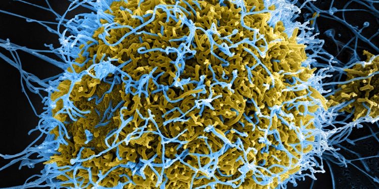 코로나 시국에 아프리카에서는 에볼라 바이러스 재창궐