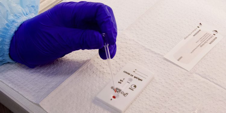 약국판매 ‘코로나19 개인 항체검사 키트’ 효과있나?