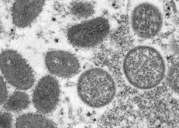 원숭이두창, 19개 국가에서 감염 확인 … ‘미국 2건’