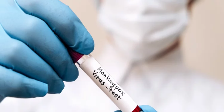 텍사스, 원숭이두창 확진 최소 12건 … “여행경험 없는 사람도 감염”