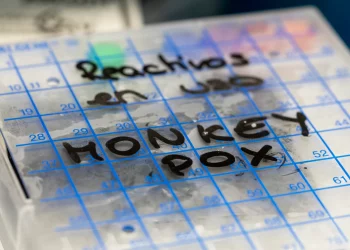 오스틴-트레비스 카운티에서도 원숭이 두창 의심사례 보고