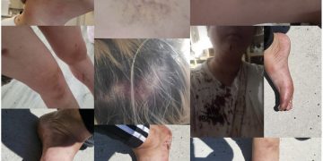 [단독] 한인 여직원 폭행한 킬린 스시집 한인업주 … “깨진 맥주병으로 턱 찔러”