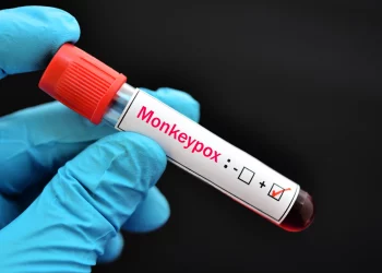 오스틴-트레비스 카운티, 원숭이두창 확진 6건 … ‘달라스 6건, 휴스턴 16건’ 보고