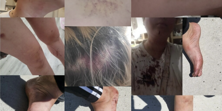 [킬린 한인 일식당 폭행] 경찰리포트 확인 … 한인업주는 ‘폭행범’, 종업원은 ‘피해자’