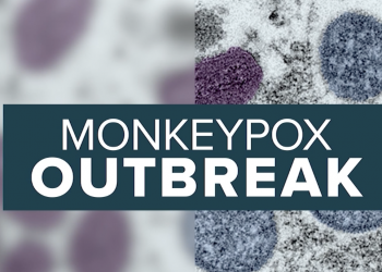 텍사스 원숭이두창 감염자 1,281명 … 휴스턴에서만 529명 보고