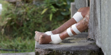 야생동물 ‘아르마딜로’를 애완용으로? … “한센병 발병 높인다”